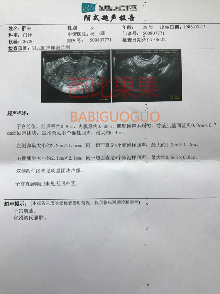 泰国试管婴儿成功移植报告图