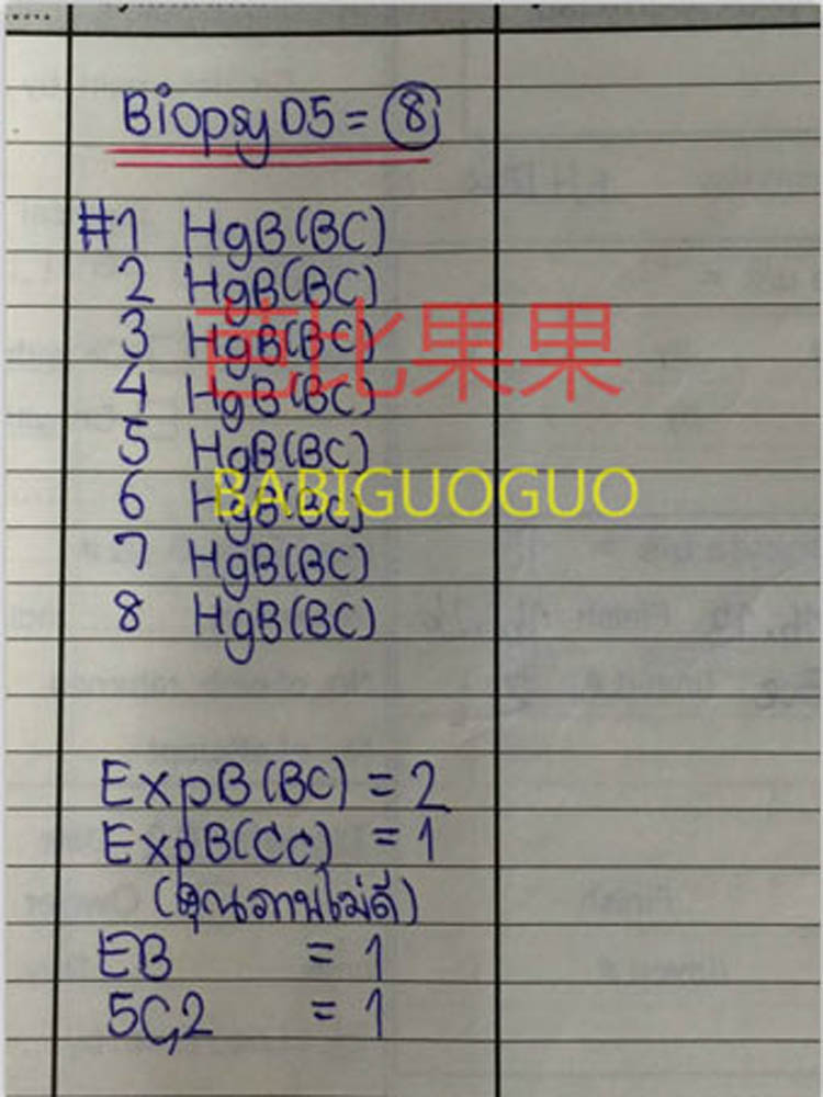 想要儿子做泰国三代试管选性别