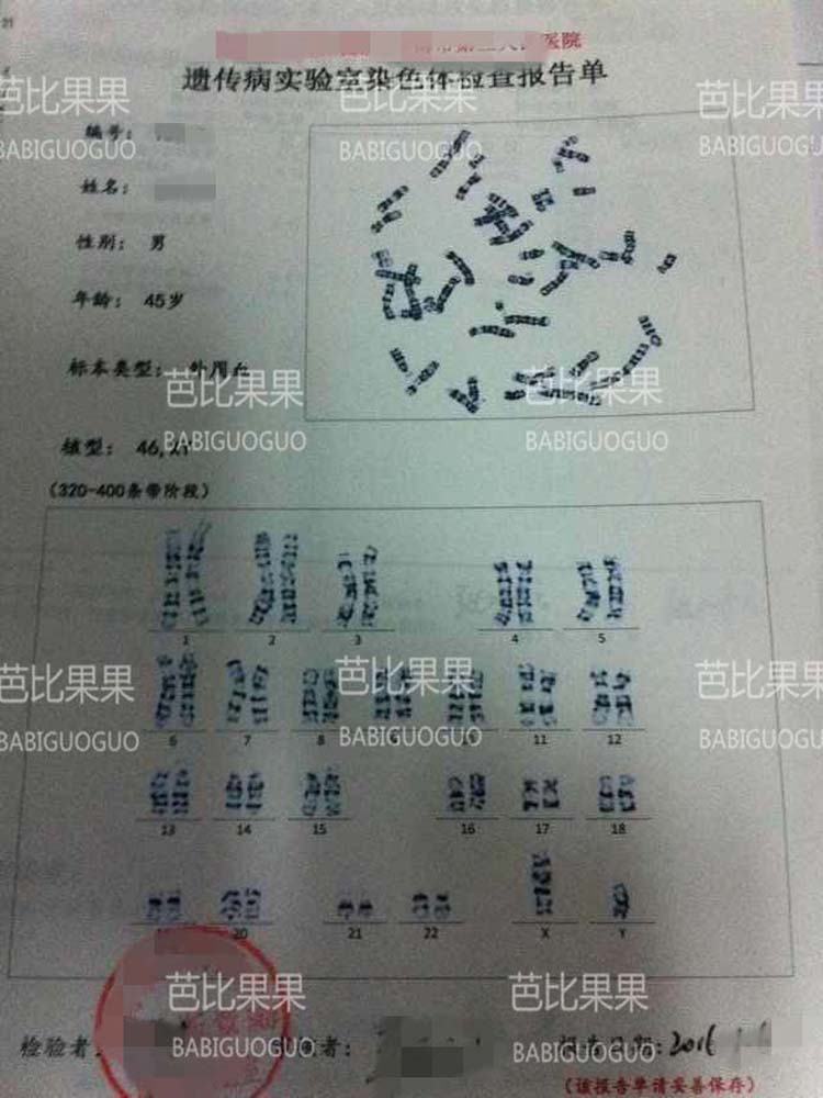 女方50岁自卵促排条件没通过 乌克兰合法试管成功