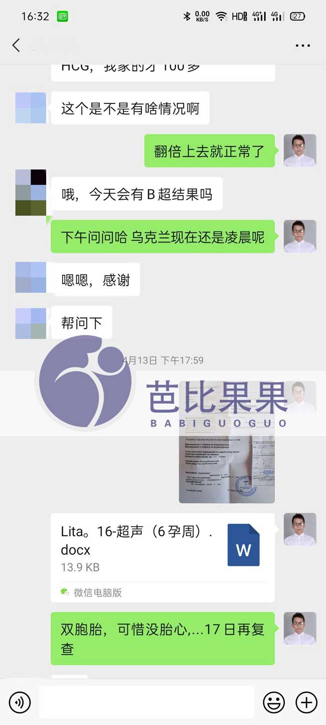 乌克兰试管代妈做B超