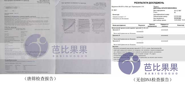 乌克兰做唐筛检查和无创DNA检查报告