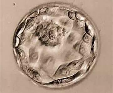 做试管婴儿到底什么情况该养囊胚？