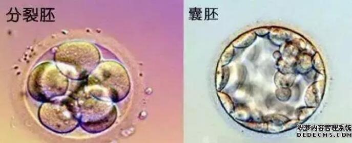泰国试管婴儿6ac囊胚移植成功较高
