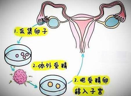 泰国试管婴儿技术