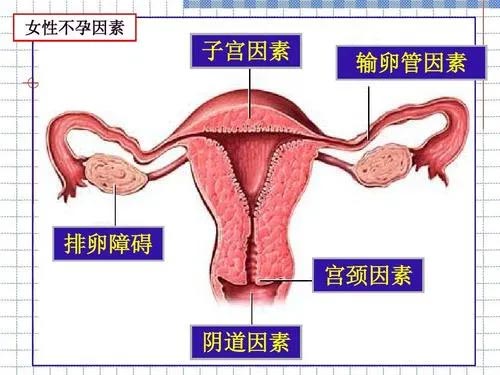 什么是排卵障碍