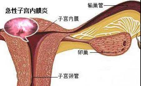 宫内膜容受性影响试管成功着床