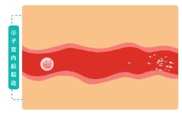 子宫内膜蠕动