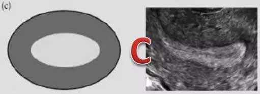 C型内膜