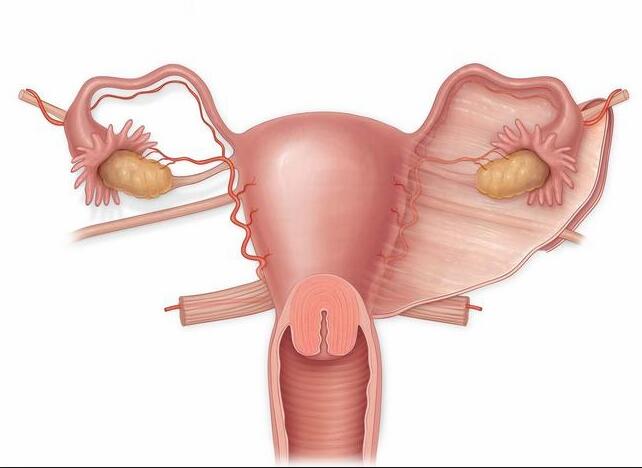  两侧输卵管切除做试管婴儿