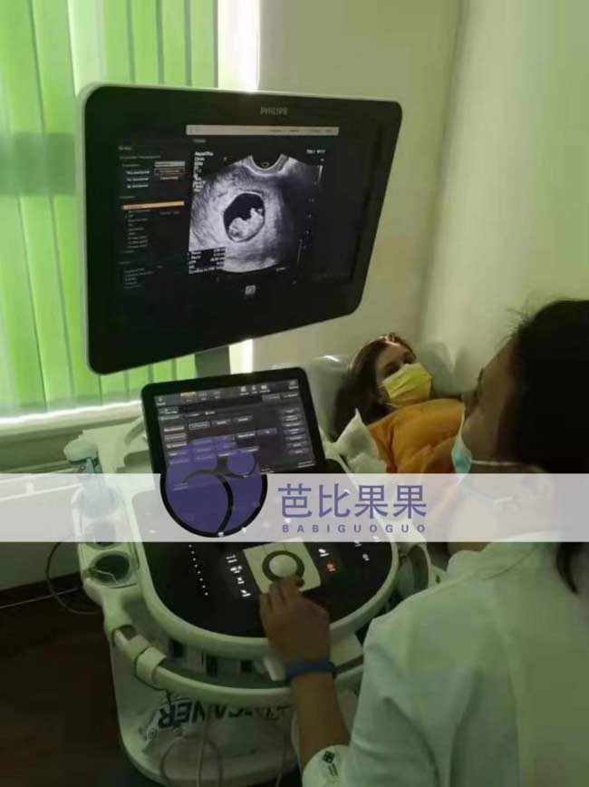 乌克兰代理孕母第二次B超