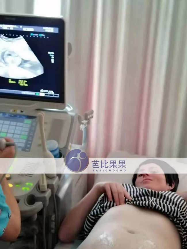 乌克兰试管妈妈做B超