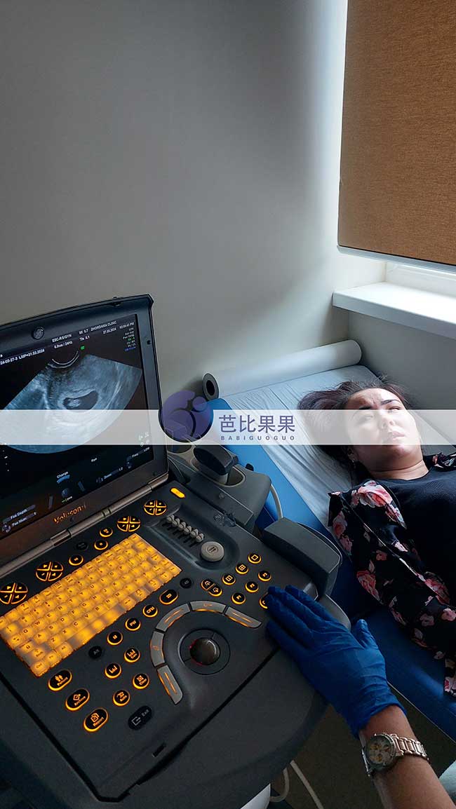 乌克兰试管妈妈做B超